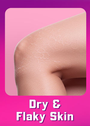 Dry & Flaky Skin