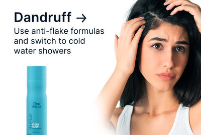dandruff