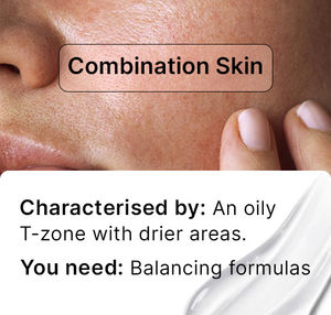 combination skin