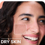 Dry Skin