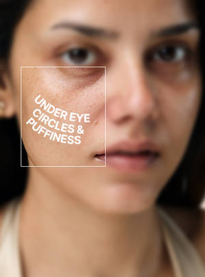 Under Eye Circles & Cream