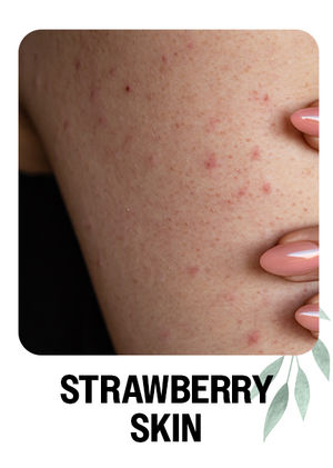Strawberry Skin