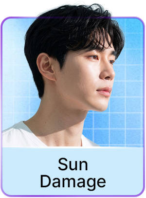 Sun Damage 