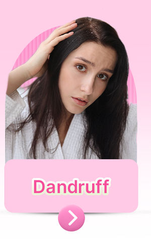 Dandruff
