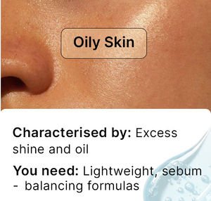Oily Skin