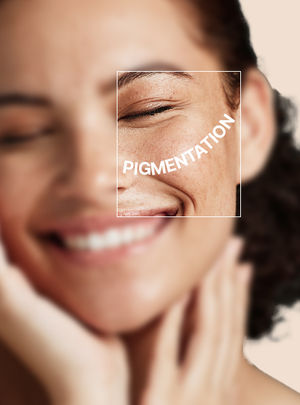 Reduce Pigmentation