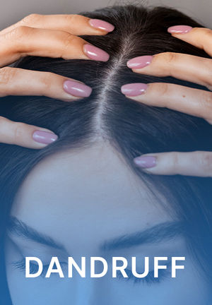 Dandruff