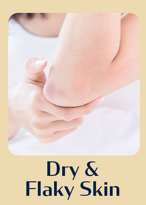 Dry & Flaky Skin