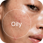 Oily