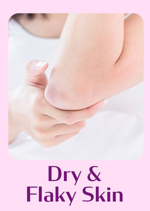 Dry & Flaky Skin