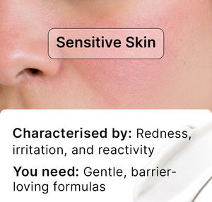 Sensitive Skin