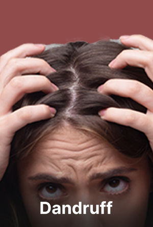 Dandruff