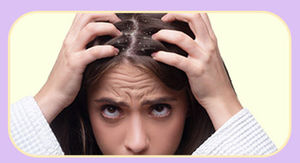 Dandruff