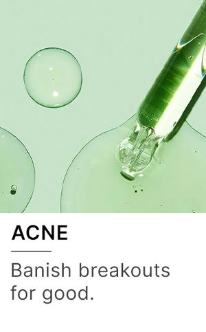 Acne