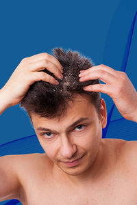 Dandruff