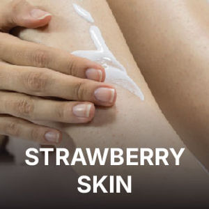 Strawberry Skin